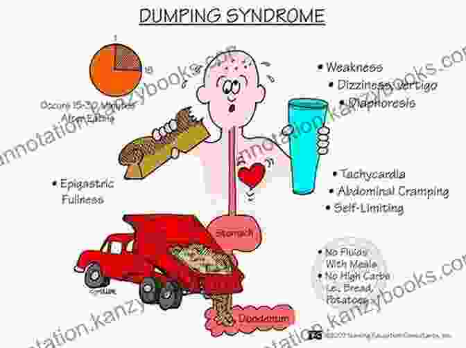 Dumping Syndrome Medications Dumping Syndrome A Reference Guide (BONUS DOWNLOADS) (The Hill Resource And Reference Guide 154)