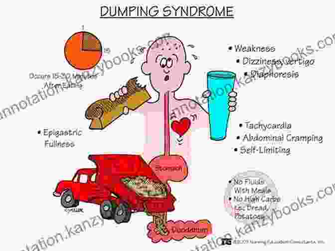 Dumping Syndrome Symptoms Dumping Syndrome A Reference Guide (BONUS DOWNLOADS) (The Hill Resource And Reference Guide 154)