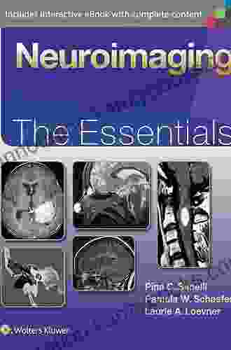 Clinical Breast Imaging: The Essentials (Essentials Series)