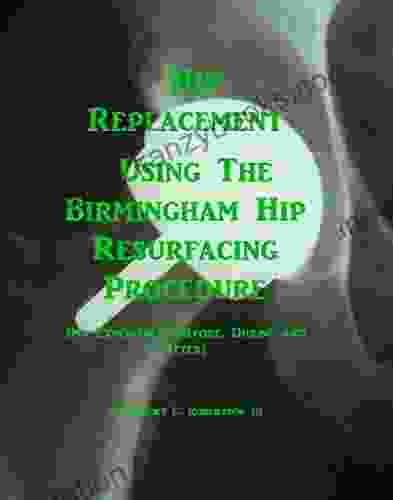 Hip Replacement Using The Birmingham Hip Resurfacing Procedure: My Experiences Before During And After