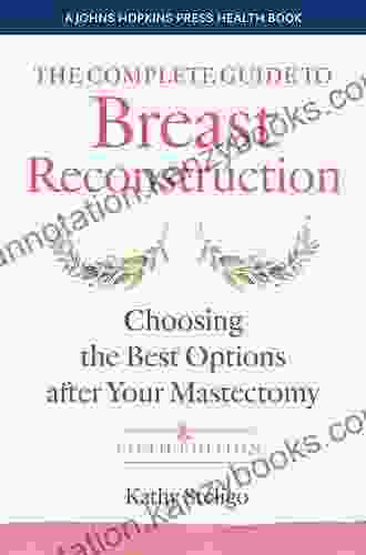 The Breast Reconstruction Guidebook Kathy Steligo